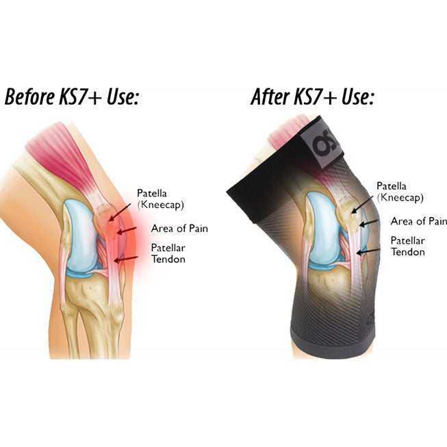 OS1st KS7+ Unisex Adjustable Performance Single Knee Sleeve - back